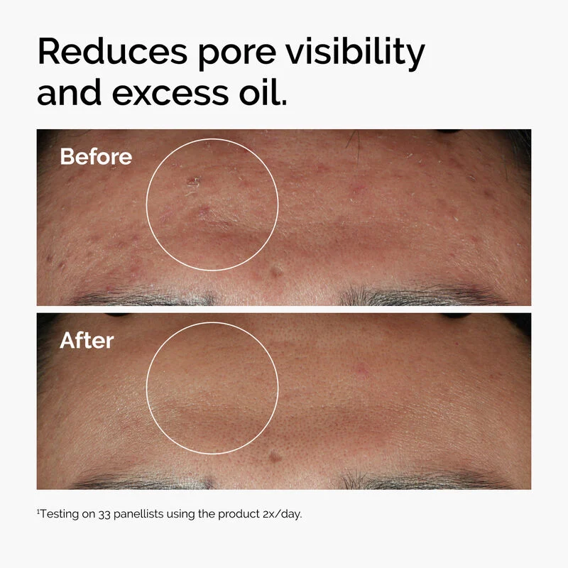 The Ordinary Niacinamide 10% + Zinc 1% - View image 6